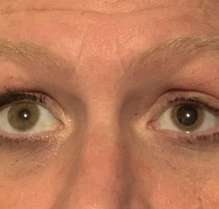 Close-up of mismatched eye colors showing an unusual detail in weirdly hilarious images to improve your feed mood.