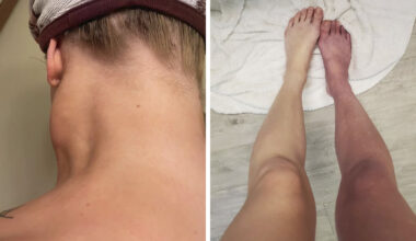 “Nearly Cost Me My Life”: 82 Body Clues That Mean You Should See A Doctor ASAP