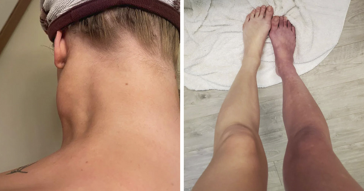 “Nearly Cost Me My Life”: 82 Body Clues That Mean You Should See A Doctor ASAP