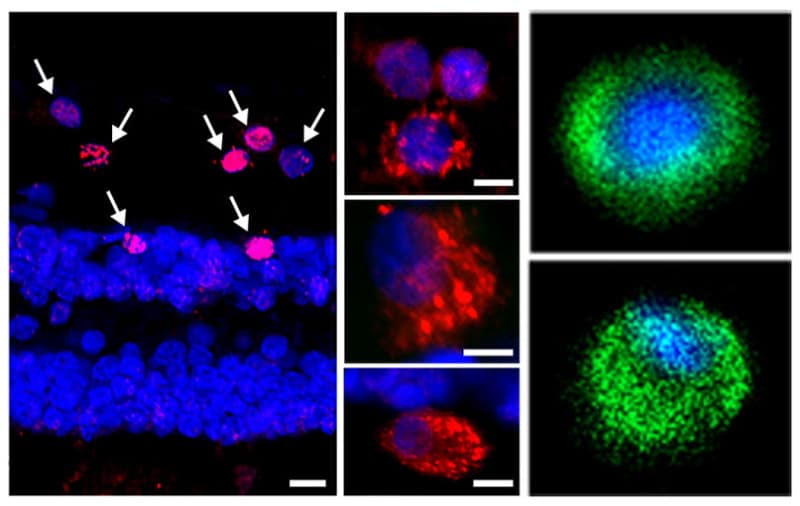 Chlamydia Pneumonia Detected In The Human Retina By Specific Monoclonal Antibody