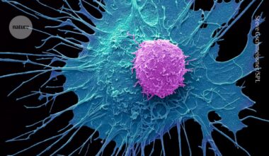 Innovative CAR-T therapy destroys cancer cells without dangerous side effects