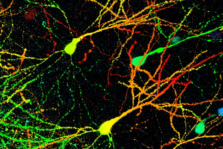 Light micrograph of multicoloured neurons from a mouse brain on a black background