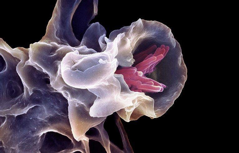 Coloured scanning electron micrograph of a macrophage white blood cell (purple) engulfing a tuberculosis (Mycobacterium tuberculosis) bacterium (pink).