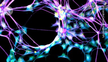 Brains of ‘super agers’ are still strong producers of new neurons