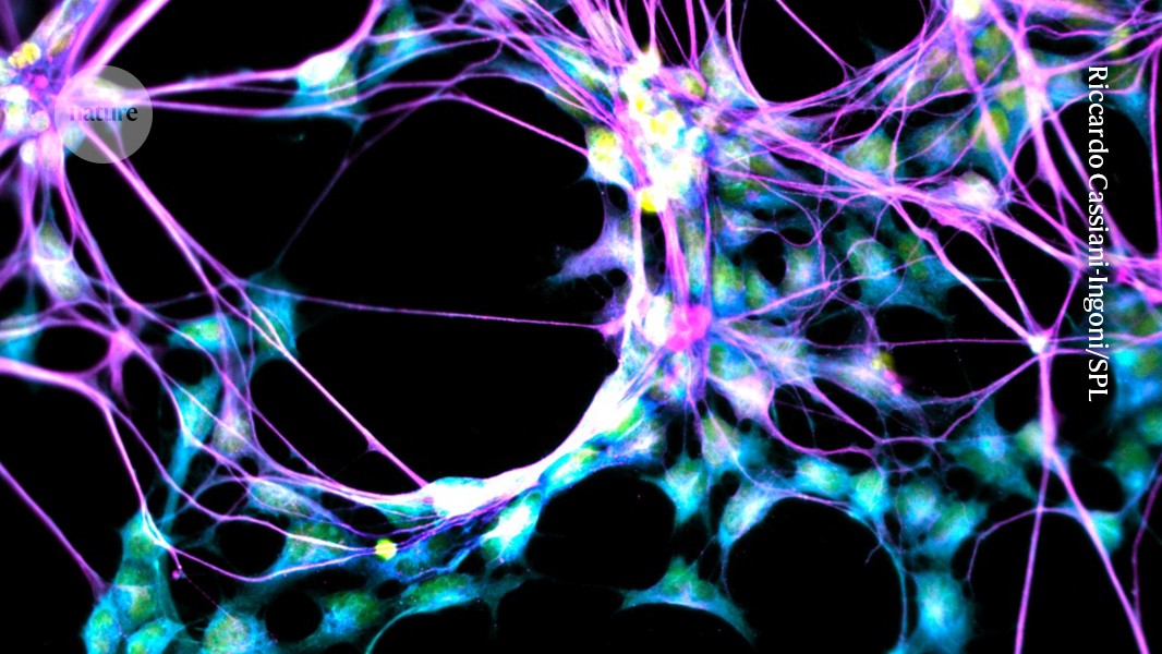 Brains of ‘super agers’ are still strong producers of new neurons