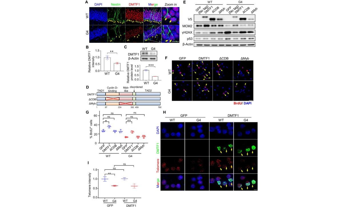 Dmtf1 Up Regulation Rescues Proliferation Defect Of Telomere Dysfunctional Mouse Nscs