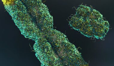 Men lose their Y chromosome as they age. Scientists thought it didn’t matter – but now we’re learning more