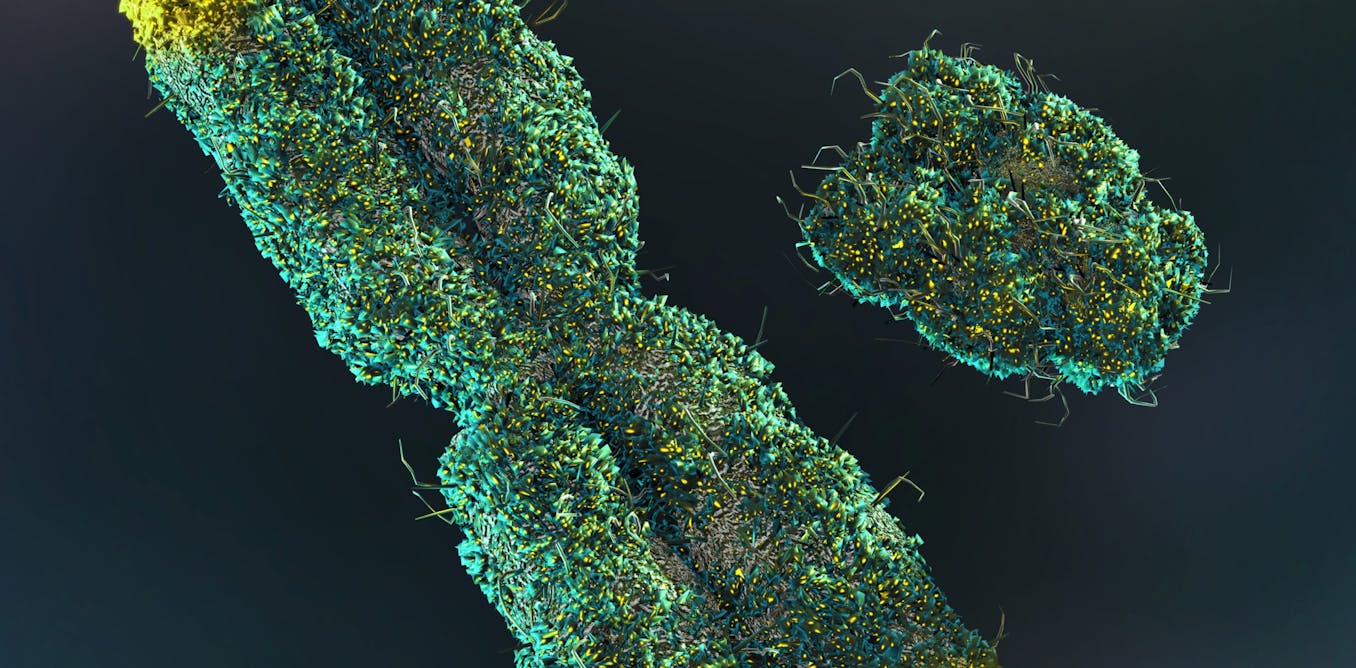 Men lose their Y chromosome as they age. Scientists thought it didn’t matter – but now we’re learning more