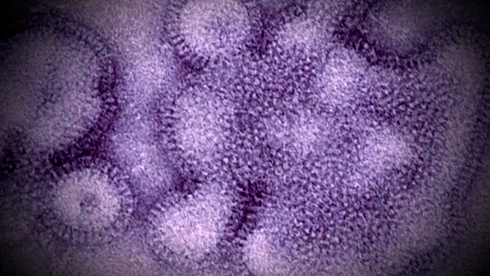 Sixth pediatric flu death reported in Massachusetts, according to state health data