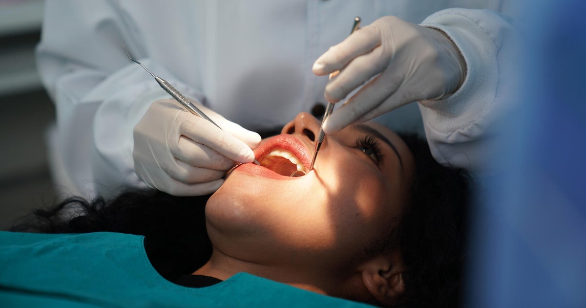 Medicaid is paying for more dental care. GOP cuts threaten to reverse the trend.