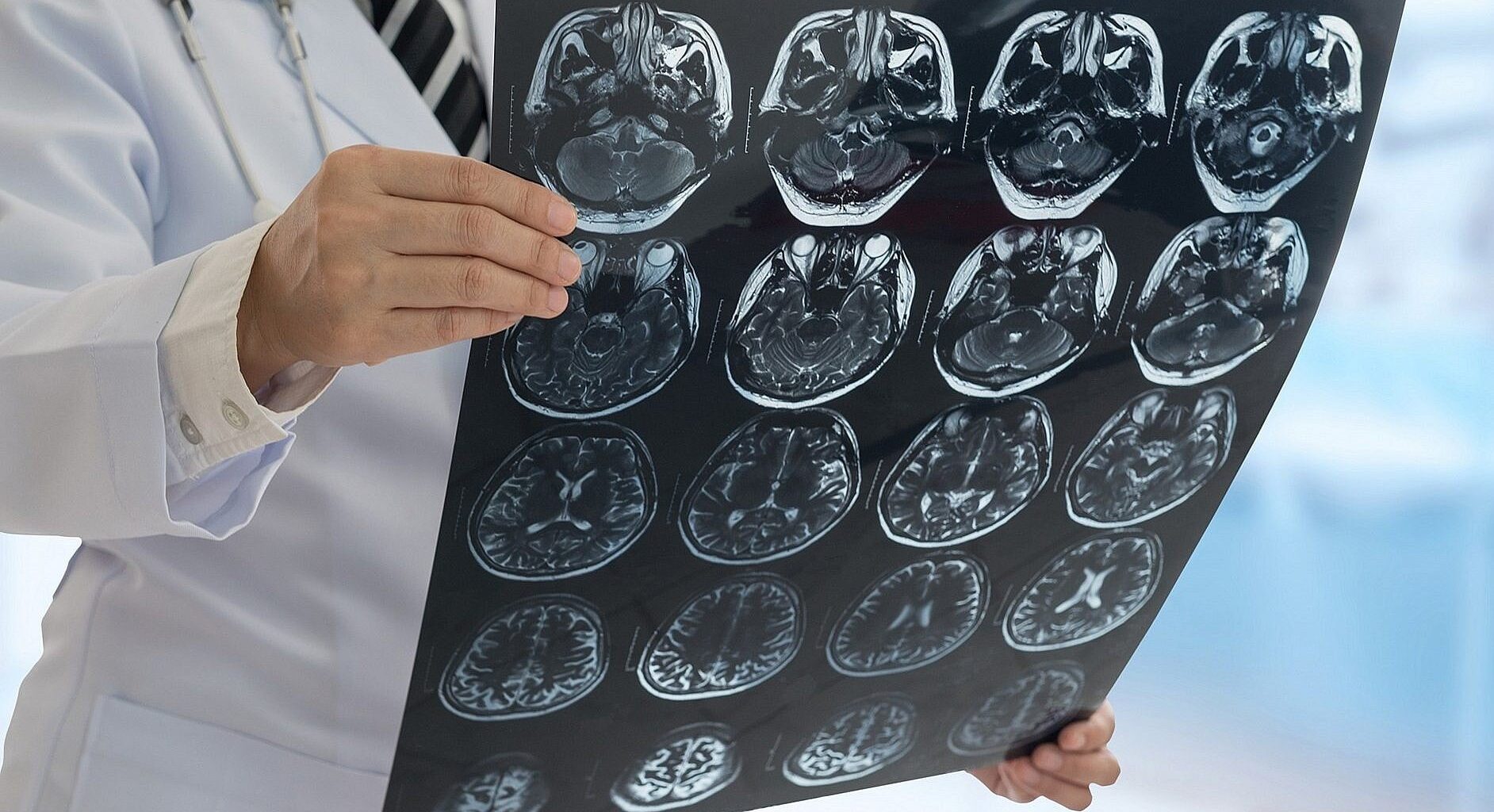 Israeli researchers identify gene that causes elusive neurodevelopmental disorder