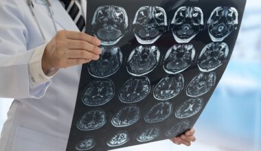 Israeli researchers identify gene that causes elusive neurodevelopmental disorder