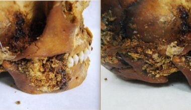 Iron Age Surgeons Fixed a Woman's Shattered Jaw With Primitive Prosthetic—and She Survived