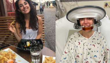 Woman shares unlikely survival journey after migraines led to glioblastoma diagnosis: "I am truly an outlier"