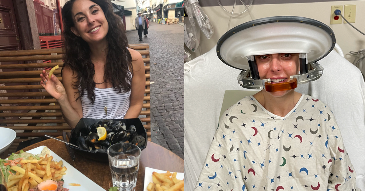 Woman shares unlikely survival journey after migraines led to glioblastoma diagnosis: "I am truly an outlier"