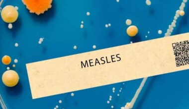 Measles Exposure Reported At This NoVA Grocery Store