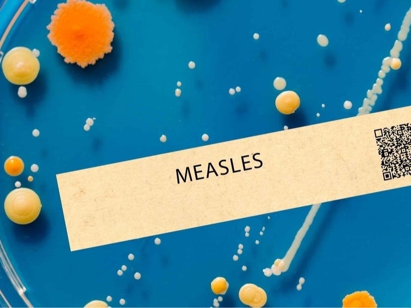 Measles Exposure Reported At This NoVA Grocery Store
