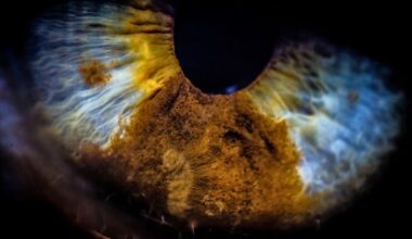 The Eye May Harbor Bacteria That Worsen Alzheimer’s Disease