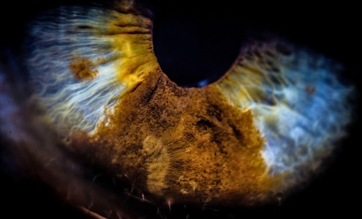 The Eye May Harbor Bacteria That Worsen Alzheimer’s Disease