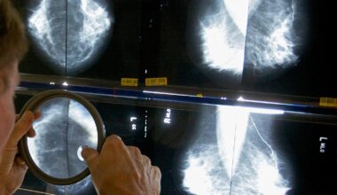 Pandemic disruptions to health care worsened cancer survival, study suggests