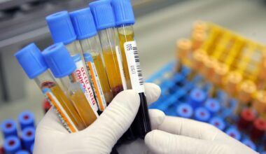 Our blood can contain proteins that hint at our likely chances of developing Alzheimer's in the near future.