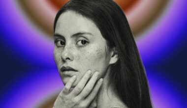 How Can I Get Rid of Dark Spots: Melasma, Hyperpigmentation