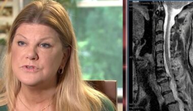 NJ mom was gowned and had an IV in when hospital tried to cancel her surgery. She ended up owing $126K for it