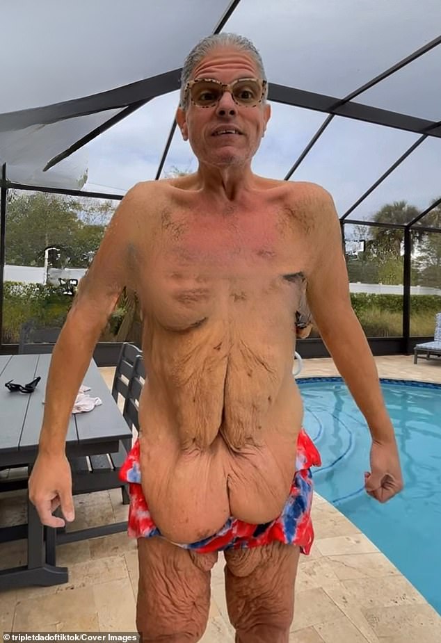 Fisher now has two reconstructive plastic surgery procedures scheduled for April, an abdominoplasty ['tummy tuck'] and a monsplasty [pubic lift]