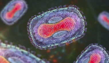 First known case of severe Mpox strain discovered in New York City