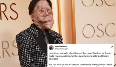 Actor Adam Pearson and fans clap back at comedian’s 'hateful' tweet about him