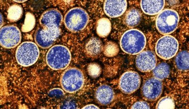 What to know about NYC's first case of severe mpox strain