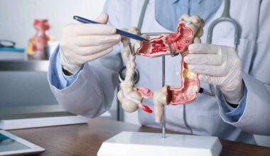 Colon cancer leading cause of cancer deaths under 50: When to see a doctor and get a colonoscopy