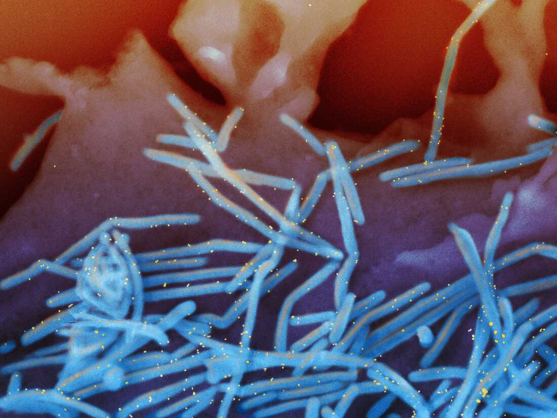 An electron microscope image provided by the National Institutes of Health shows human respiratory syncytial virus virions, colorized blue, and antibodies against an RSV protein, colorized yellow.