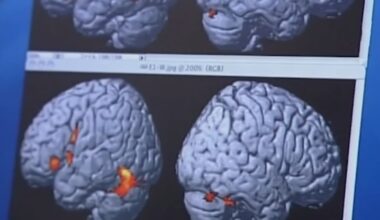 Duke nursing student joins national push to improve early Alzheimer's detection