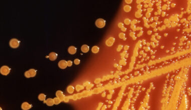 FILE PHOTO: Colonies of E. coli bacteria are seen in a microscopic image