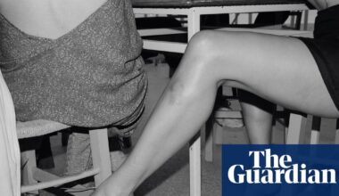 ‘Arms and legs are very expressive, especially with bruises’: the absurdist photography of Yorgos Lanthimos | Photography