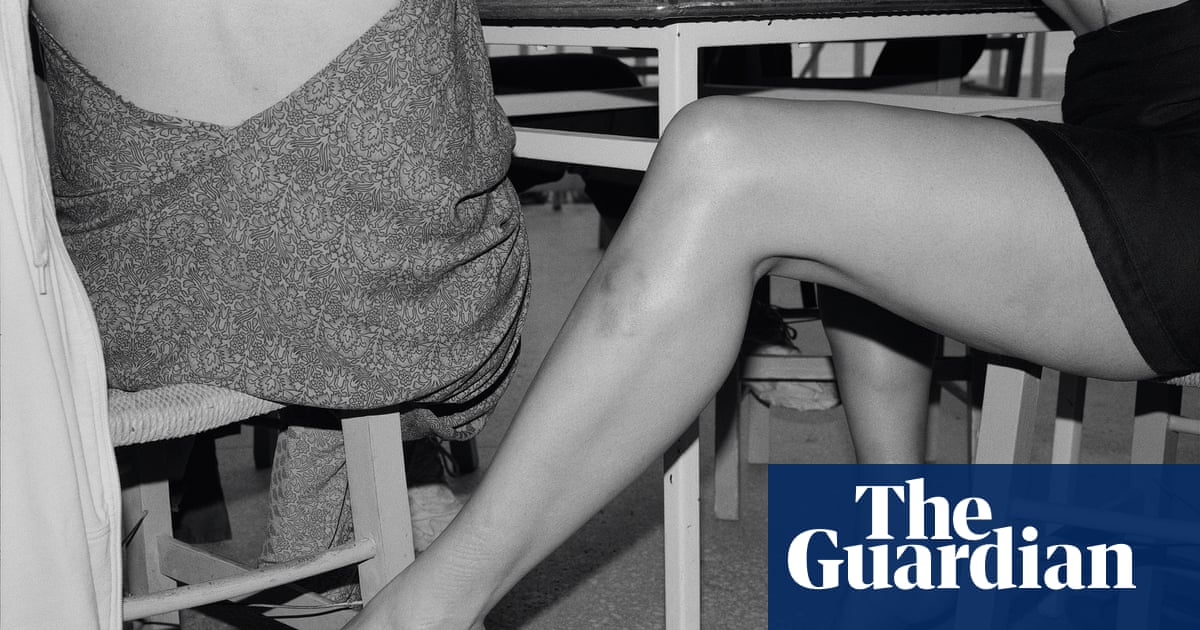 ‘Arms and legs are very expressive, especially with bruises’: the absurdist photography of Yorgos Lanthimos | Photography