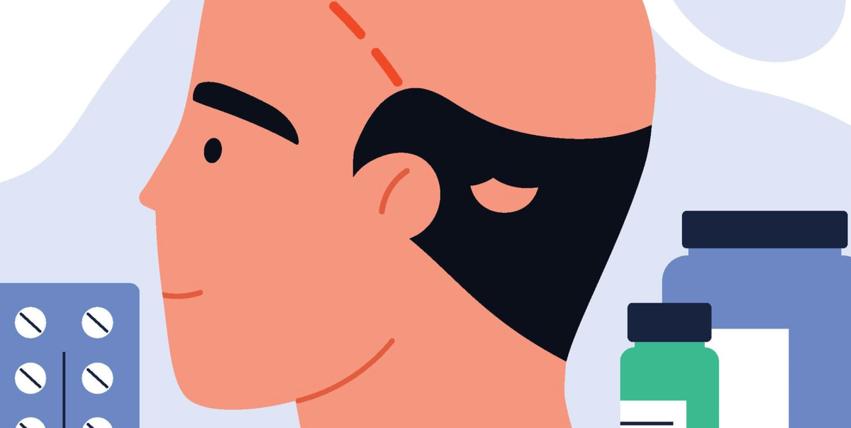 We Need to Talk About Finasteride – and Growing Concerns Around the Hair-Loss Drug