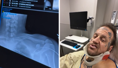 Jelly Roll Was at Grammys With a Broken Collarbone From ATV Crash, Bunnie Posts Vid