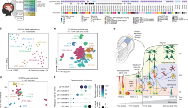 Multidimensional profiling of heterogeneity in supratentorial ependymomas