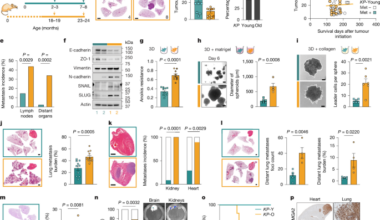 Ageing promotes metastasis via activation of the integrated stress response
