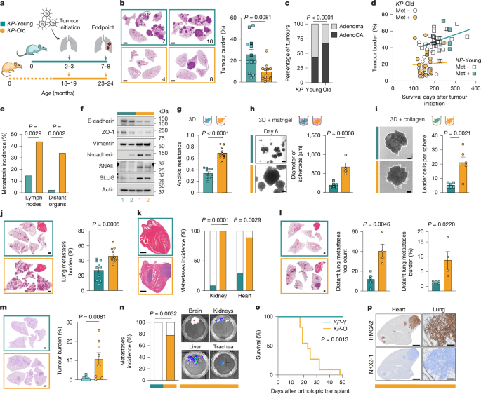 Ageing promotes metastasis via activation of the integrated stress response