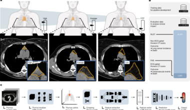 Thymic health consequences in adults