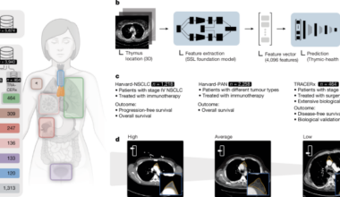 Thymic health and immunotherapy outcomes in patients with cancer