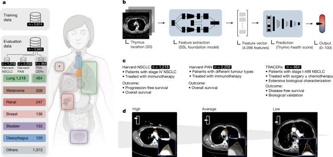 Thymic health and immunotherapy outcomes in patients with cancer