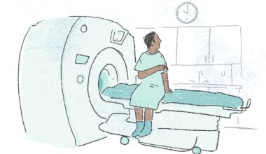 Coping with the anxiety of not knowing what’s going on inside my brain