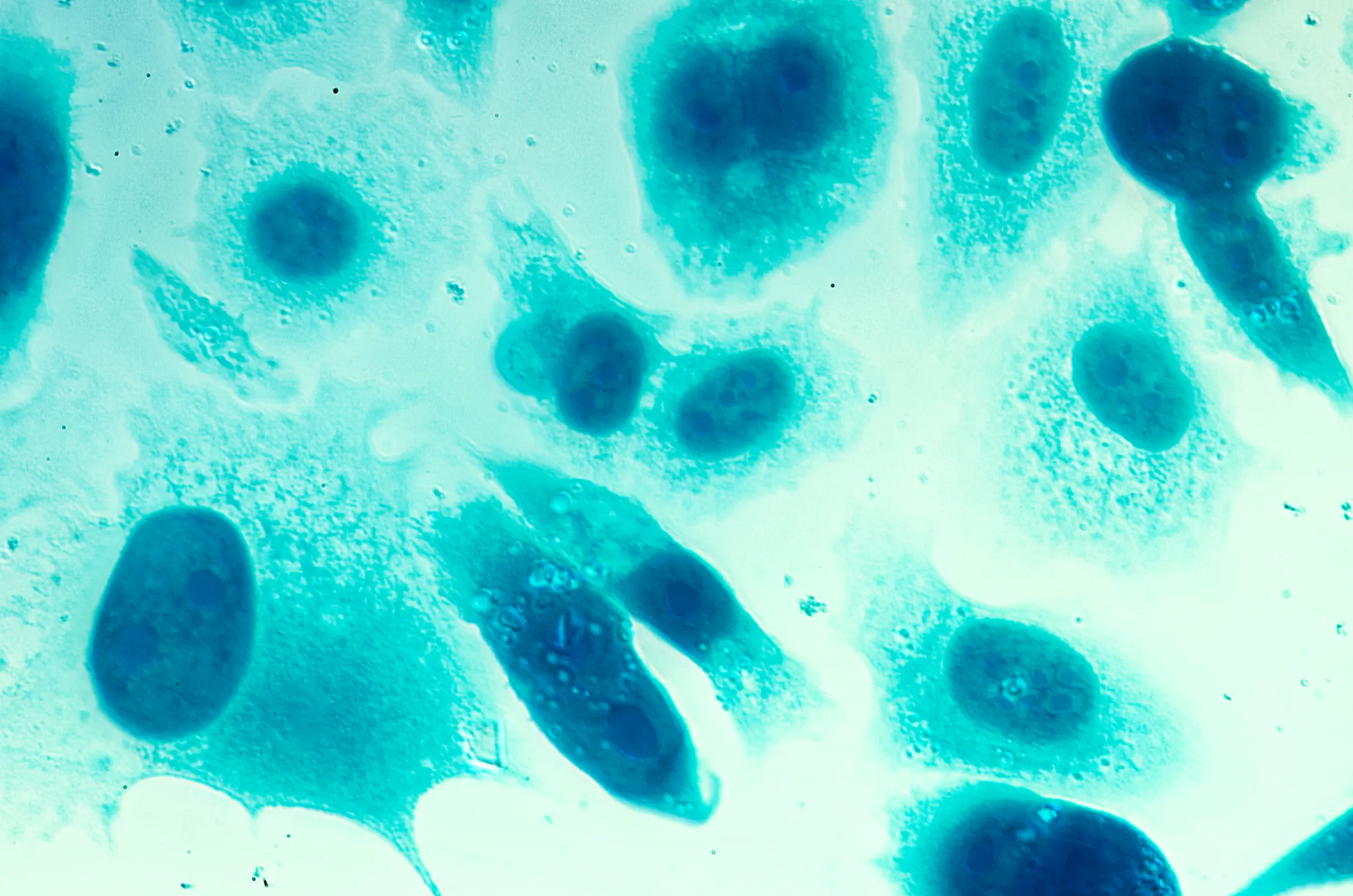 PC-3 human prostate cancer cells, stained with Coomassie blue, under differential interference contrast microscope.