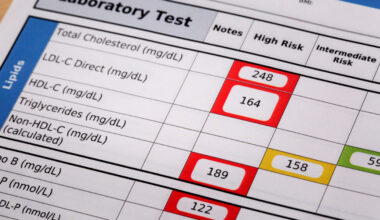 New heart disease guidelines suggest statins as early as age 30