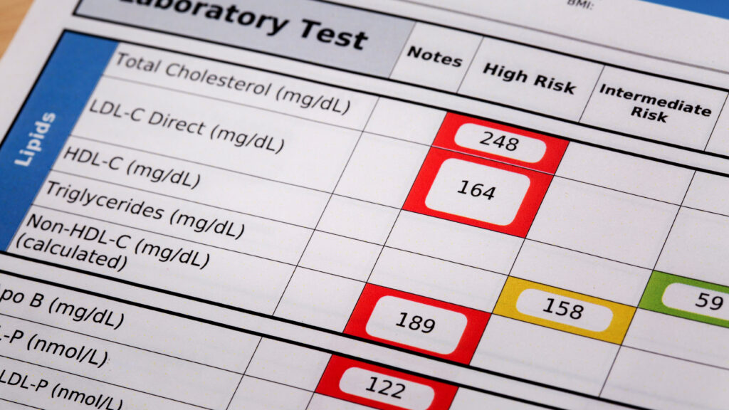 New heart disease guidelines suggest statins as early as age 30
