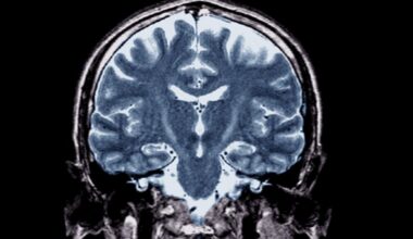 With Trump in office, an ALS cure seems farther than ever